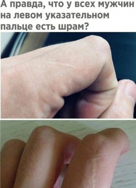 Шрам